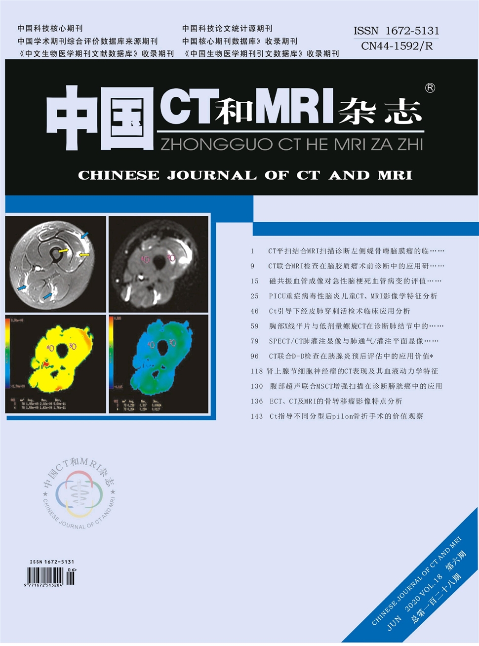 中国CT和MRI杂志